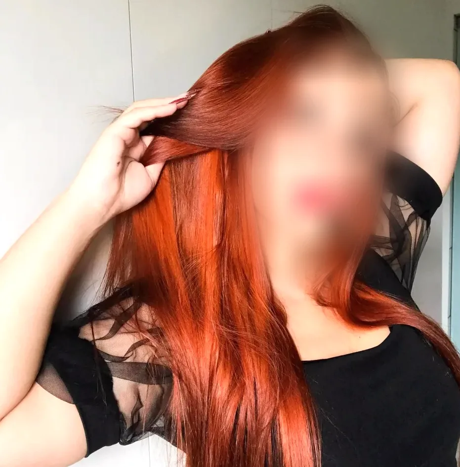 Aurora, 32 anni